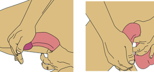 Modalități de masaj al penisului - Penis mic sau cocoș